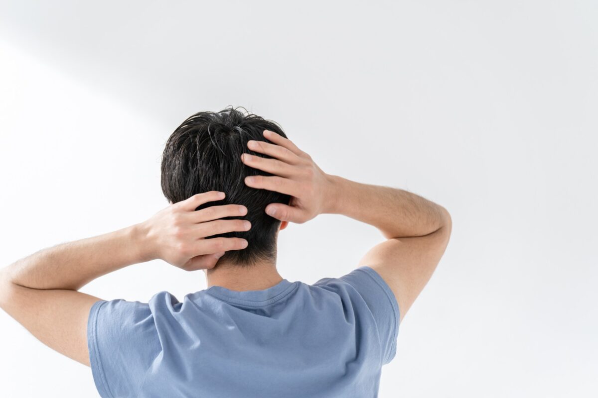 AGAの症状と進行