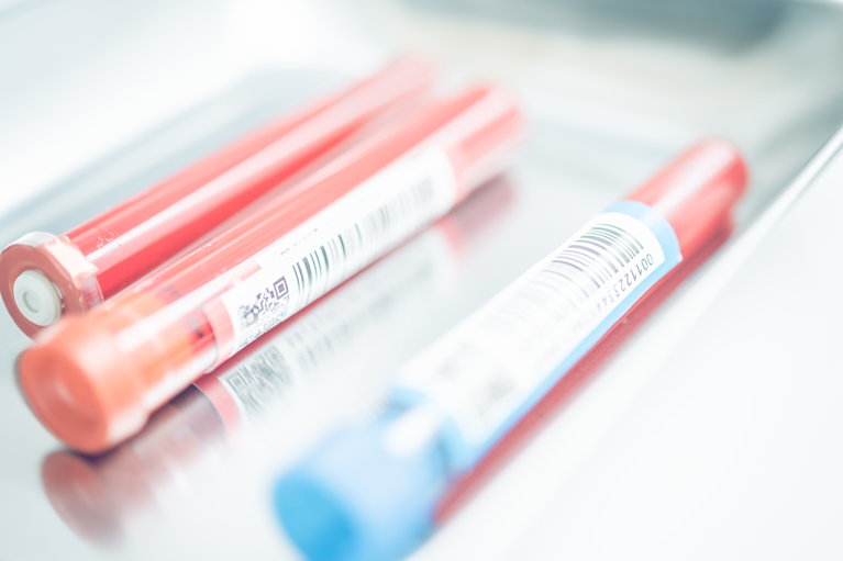 当院で行うアレルギー検査の種類