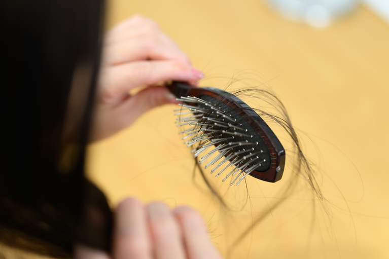 女性特有の円形脱毛症の原因