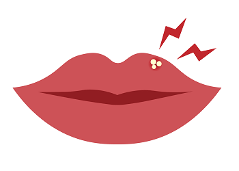 ヘルペスとは？