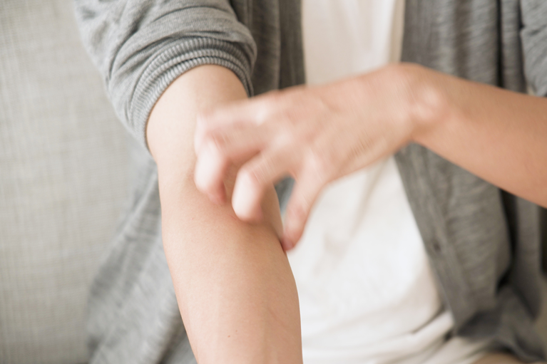 一般的な症状からわきが・多汗症・爪治療まで幅広く柔軟な診療アトピー性皮膚炎