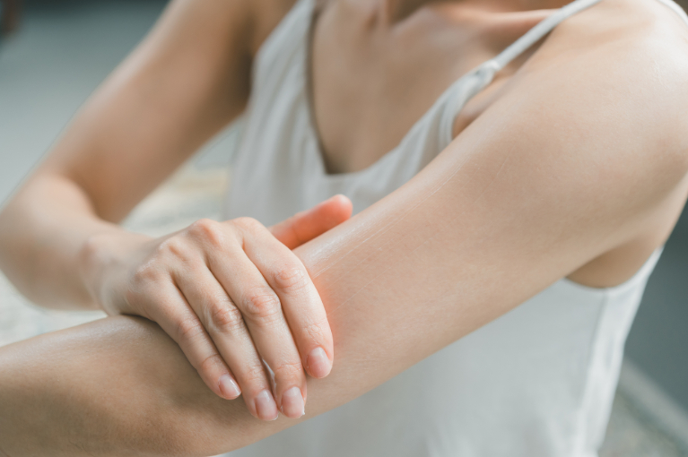 あざ（黒あざ・茶あざ）