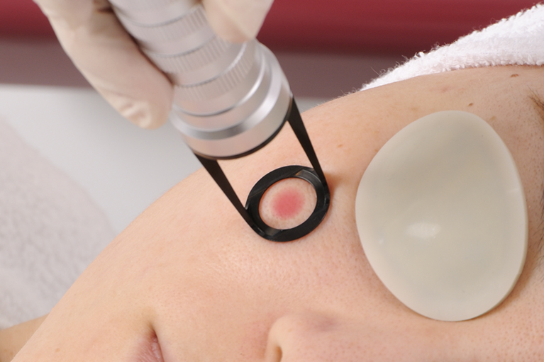 高い治療効果が期待できる