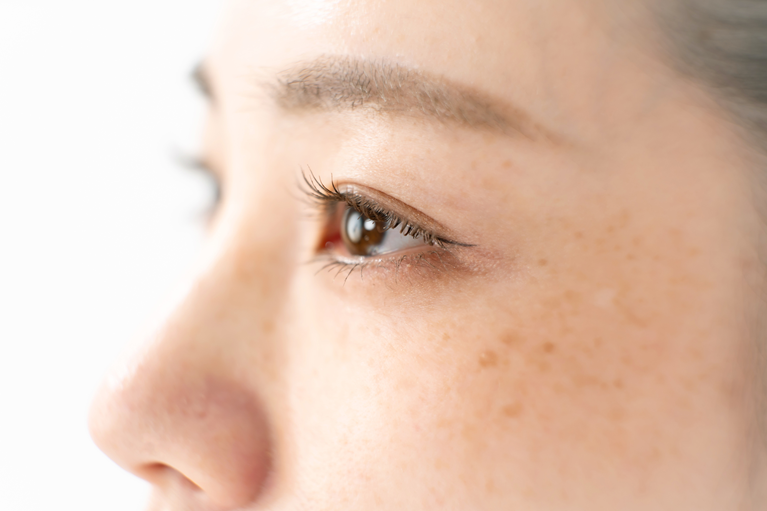 シミとはどういうもの？